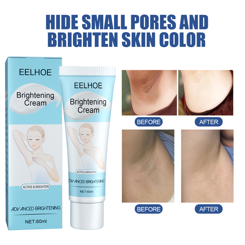 EELHOE Achselcrème fir d'Schéinheet vun den Aarme Feuchtigkeitscreme, hydratiséierend, hydratiséierend, Knéi-Ellbogen-Concealer, befeuchtend, zärt an ophellend Hauttéin_voghion.com