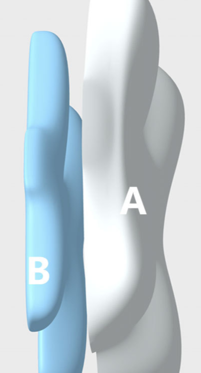 Cervical Pillow For Neck And Shoulder,Contour Memory Foam Pillow,Ergonomic Neck Support Pillow For Side Back Stomach Sleepers With Pillowcase_voghion.com