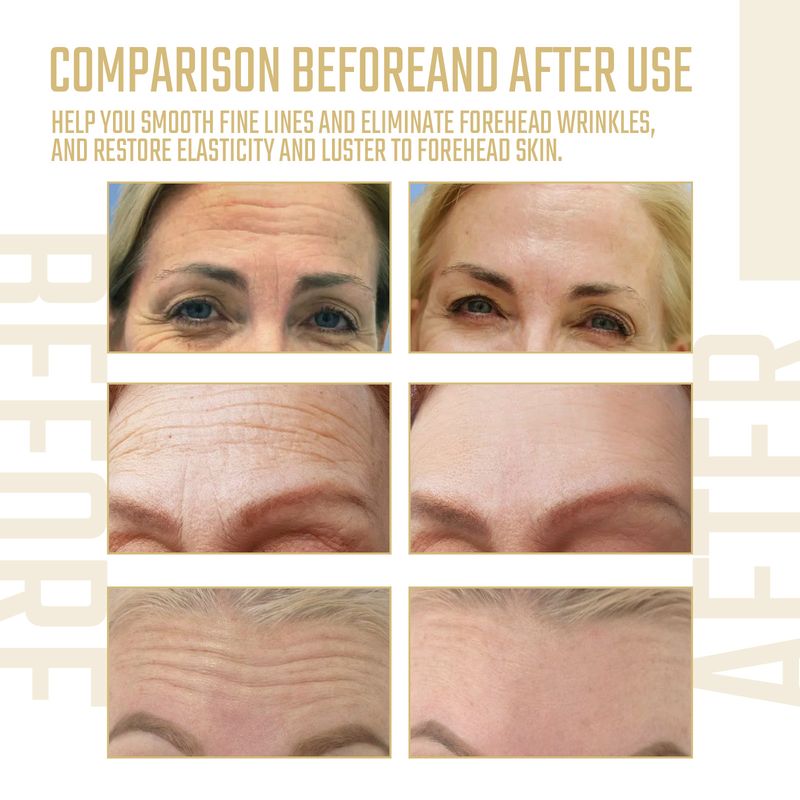 West&Month Collagen Forehead Patch, Fade Forehead Lines And Smooth Fine Lines And Forehead Lines_voghion.com