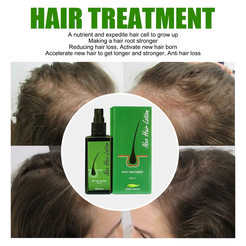 Growth Original Neo Uniex Anti Hair Lo Pilatory Natural Extract Baldne Lotion Eence Oil Repair Grow Spray tion_voghion.com