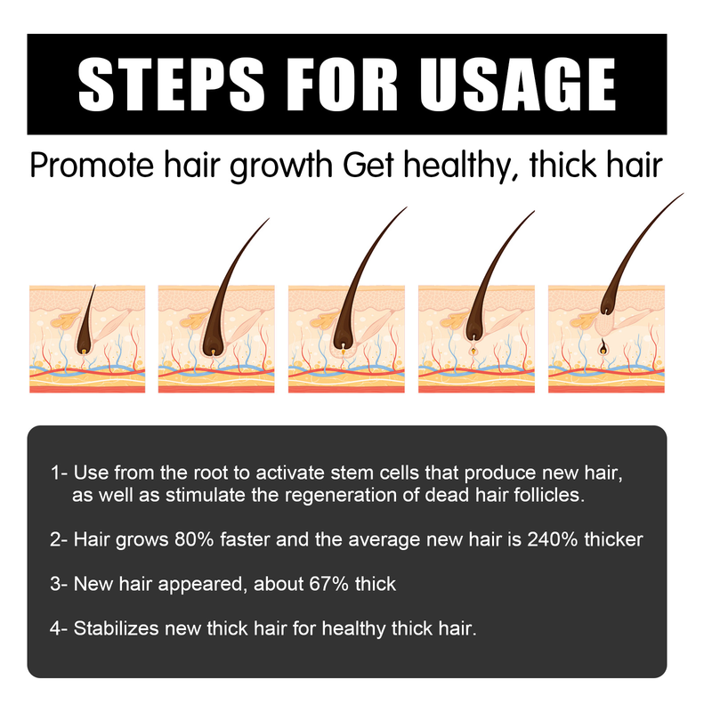 Jaysuing Scalp favorise l'épaississement du peigne à cheveux de massage à rouleaux_voghion.com