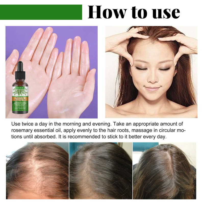 EELHOE Rosemary Breaking Care Growth and Anti Loss eterisk olja för närande hår_voghion.com