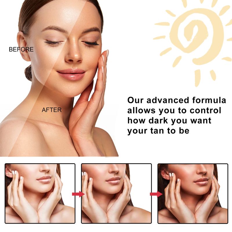 OUHOE must kreem aaloe vera geel, päikesepõletuse parandav geel suvine rannapäevituskreem_voghion.com