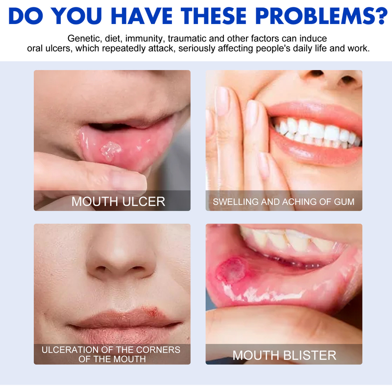 Oral South Moon Repair szájspray a gingivális tűz, duzzanat, fájdalom és fogágybetegség okozta hólyagosodás enyhítésére_voghion.com