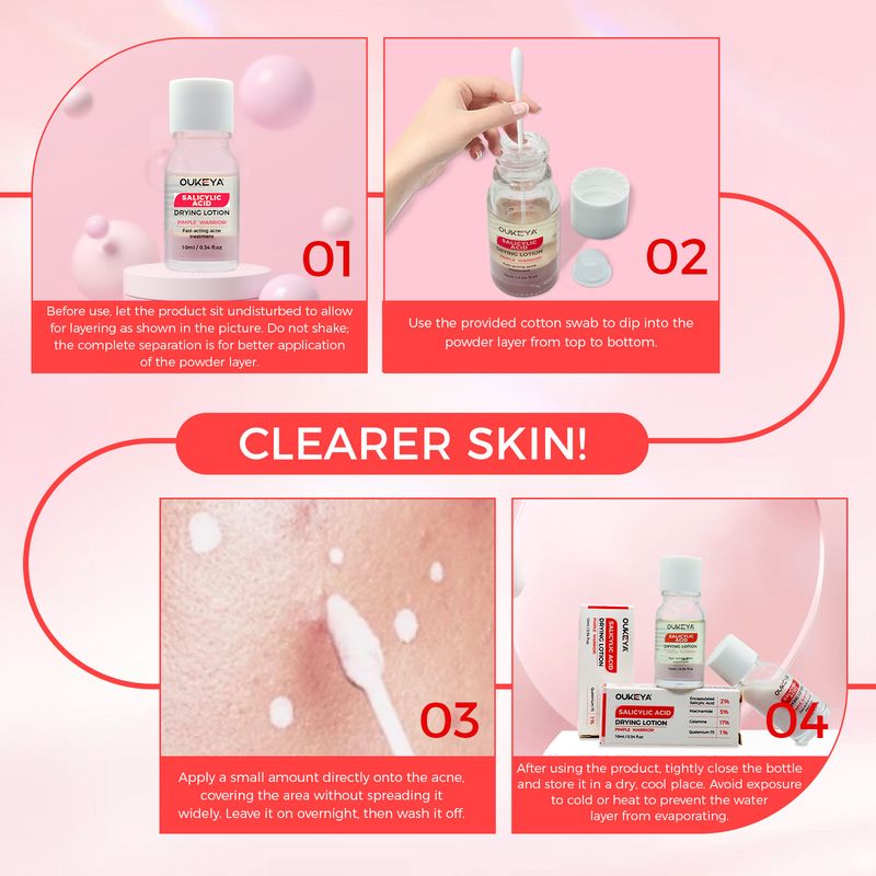 Siero Doppio Acido Acne Polvere Acqua Acido Salicilico Schiarisce Pelle Acne Segni Acneici Viso Pelle di Gambero Estate Acne Polvere Acqua_voghion.com