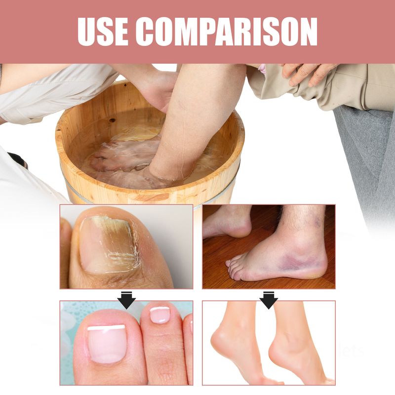 EELHOE Essence Compressa per Pediluvio Effervescente per la Pulizia del Corpo e la Cura Profonda Cocoon, Allevia Dolore e Gonfiore_voghion.com