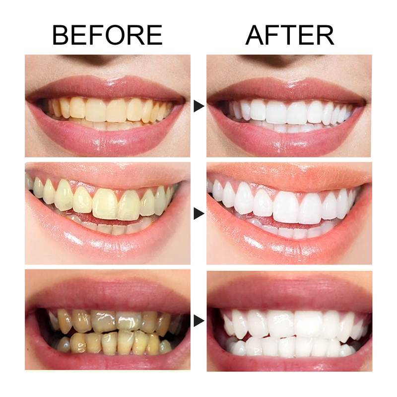 2024 Mousse Deep Cleansing Tooth Dirt Gingival Fresh Breath Oral Care Toothpaste_voghion.com