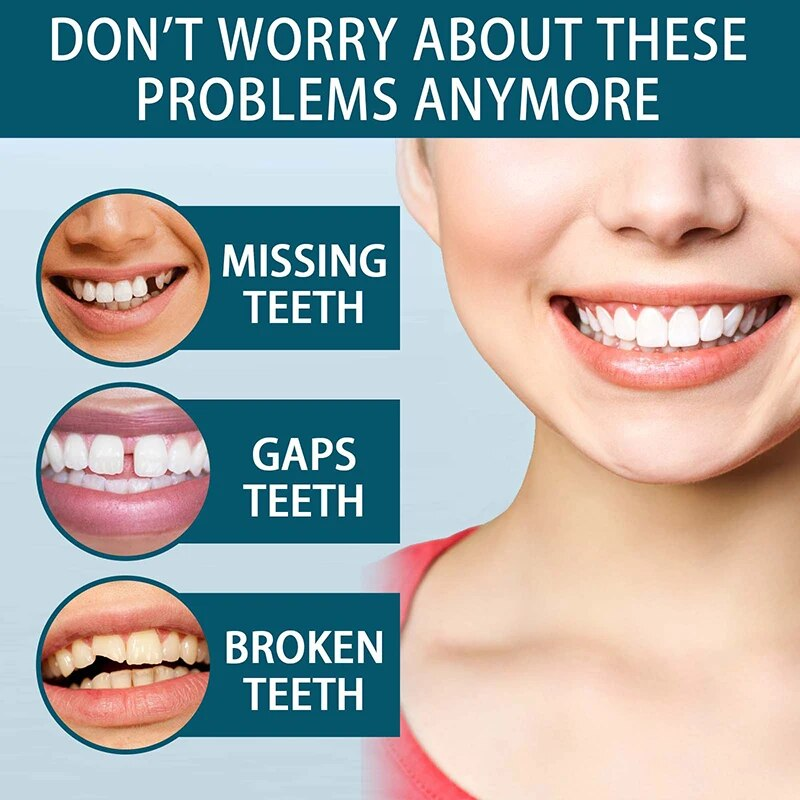 Set regolabile Impiallacciatura sorridente istantanea Sbiancamento denti per protesi Decora gli spazi tra i denti_voghion.com