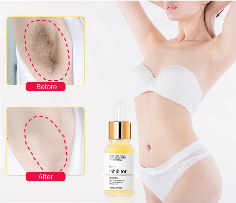 Trvalý krém na rychlé odstranění chloupků, sérum na inhibici růstu chloupků, mírný bezbolestný odstraňovač, silný inhibitor růstu chloupků_voghion.com