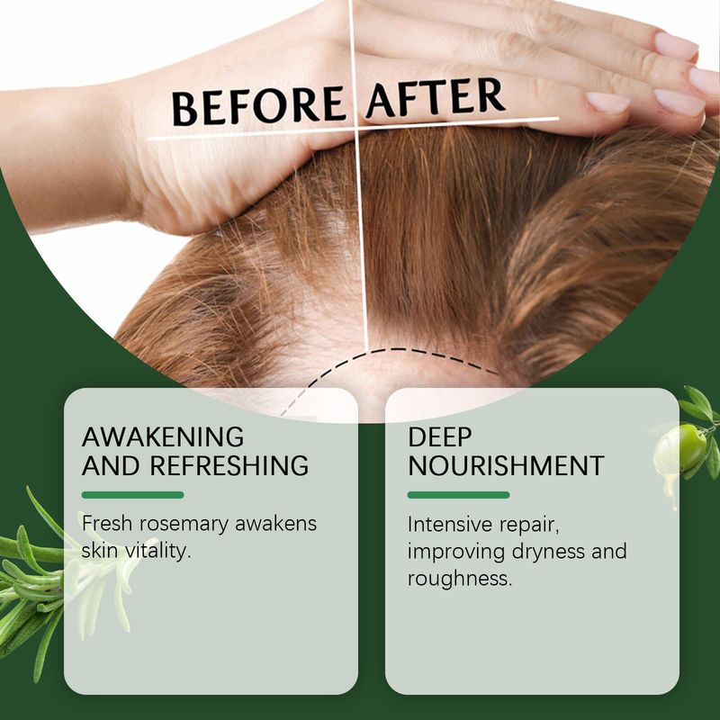 Huile essentielle de romarin, nourrissante pour le cuir chevelu Huile essentielle de soin adoucissante et moelleuse à l'essence de romarin_voghion.com