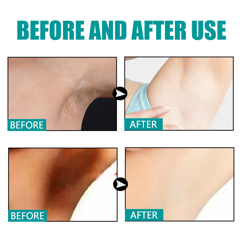 Armpit Brightening Beautiful essence Moisturizing&Rejuvenating Skin Brightening&Desalinating Melanin Brightening Armpi _voghion.com