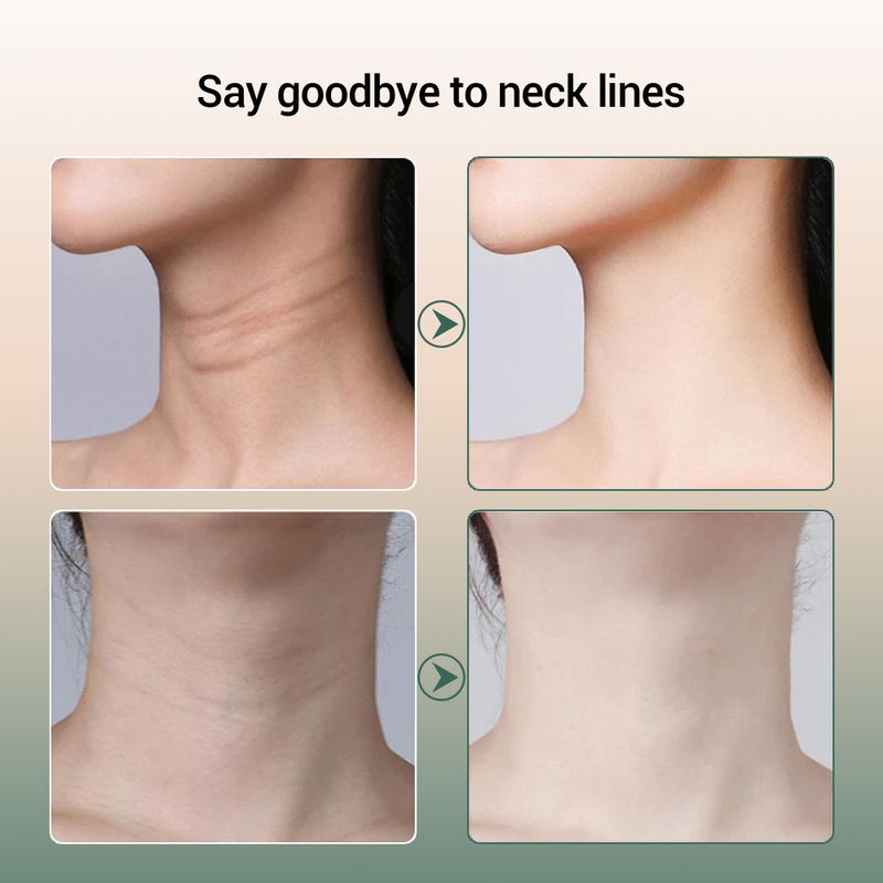 Skønhed hals instrument Hjem nakke massager løft til farve lys øm hud for at fjerne hals linjer skønhed instrument_voghion.com