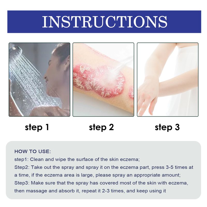 2025 Calfskin Soothing Spray Skin Hand Foot Moss Itching And Swelling Care Spray_voghion.com