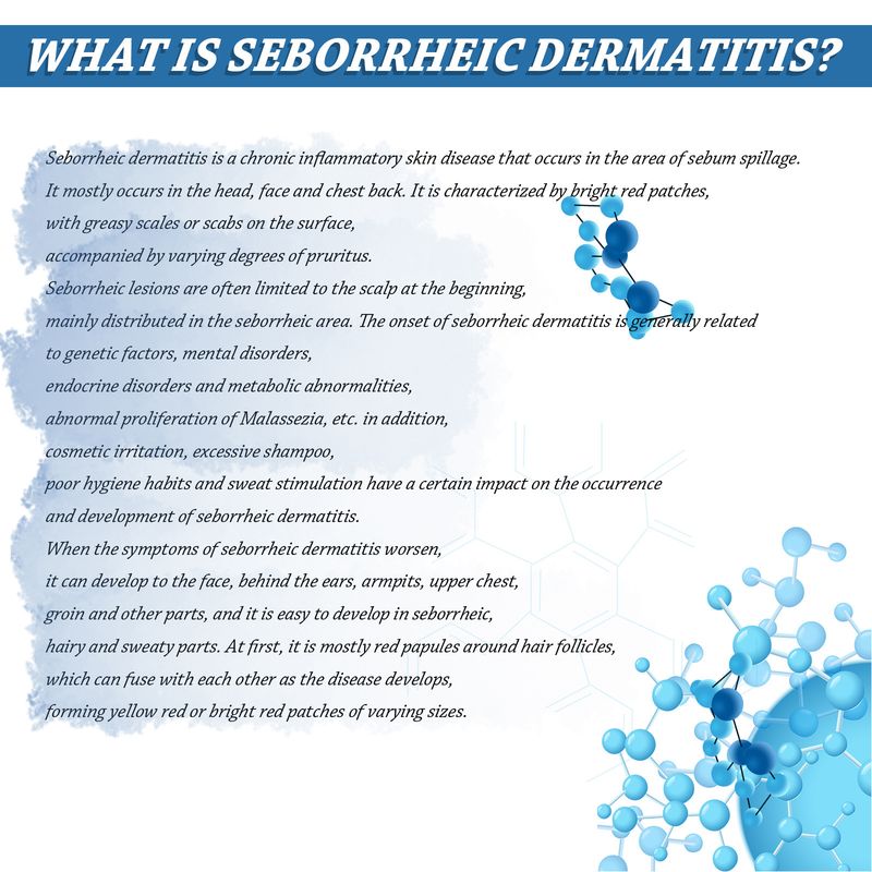 Cremă seboreică South Moon pentru repararea problemelor pielii precum acneea, mâncărimea și psoriazisul de pe cap_voghion.com
