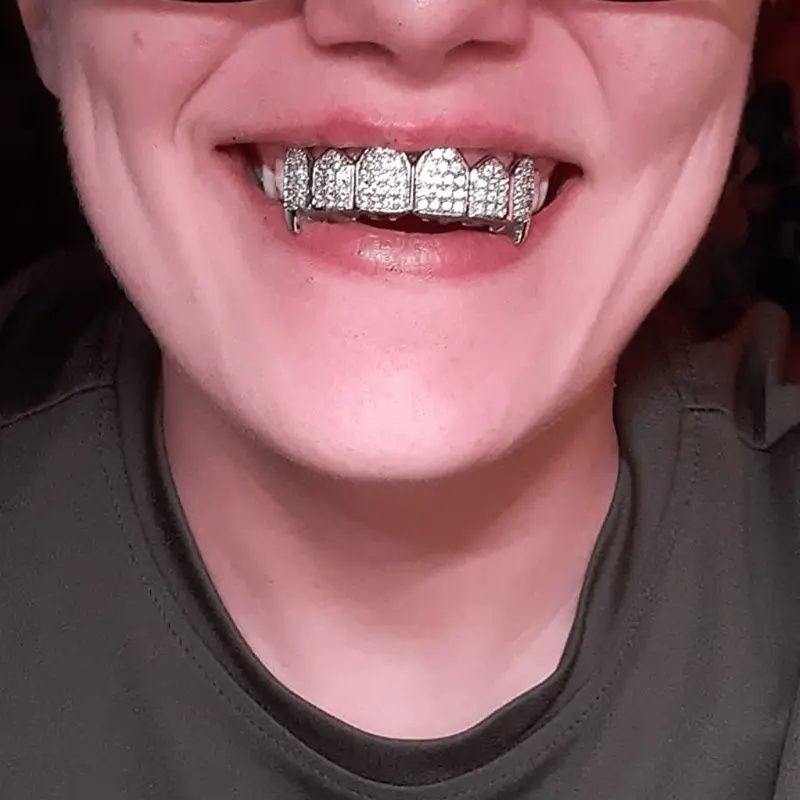 Aurora Atelier Diamond Flash Hip-Hop-Zahnspange, vergoldete Zähne, Festival-Zahnschmuck, personalisierte Rap-Zahndekoration_voghion.com