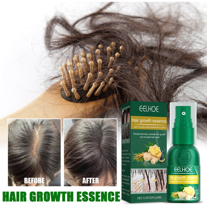EELHOE Massaggio del cuoio capelluto per la crescita dello zenzero Idratante Spray nutrizionale per la cura dei capelli spessi e resistenti_voghion.com