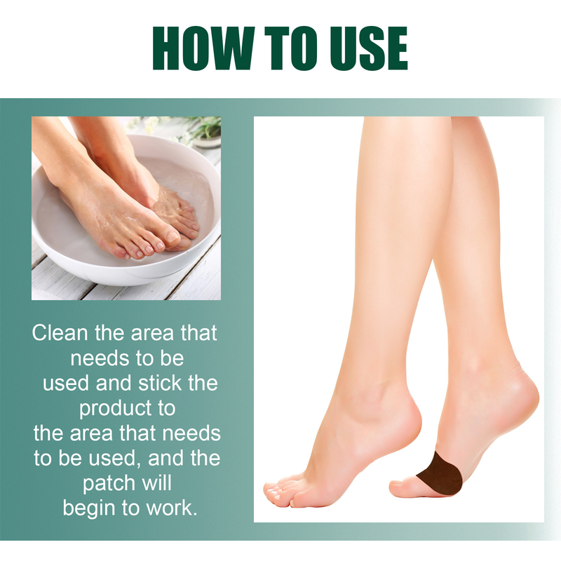 thumb bursitis Beautiful relief patch for thumb valgus big foot bone bursitis valgus double toe care patch_voghion.com