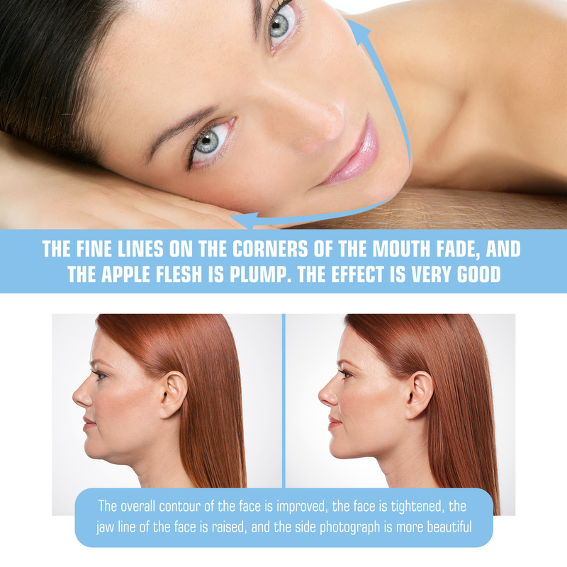 EELHOE Double chin tightening small face shaping ear hook V-lift facial mask_voghion.com