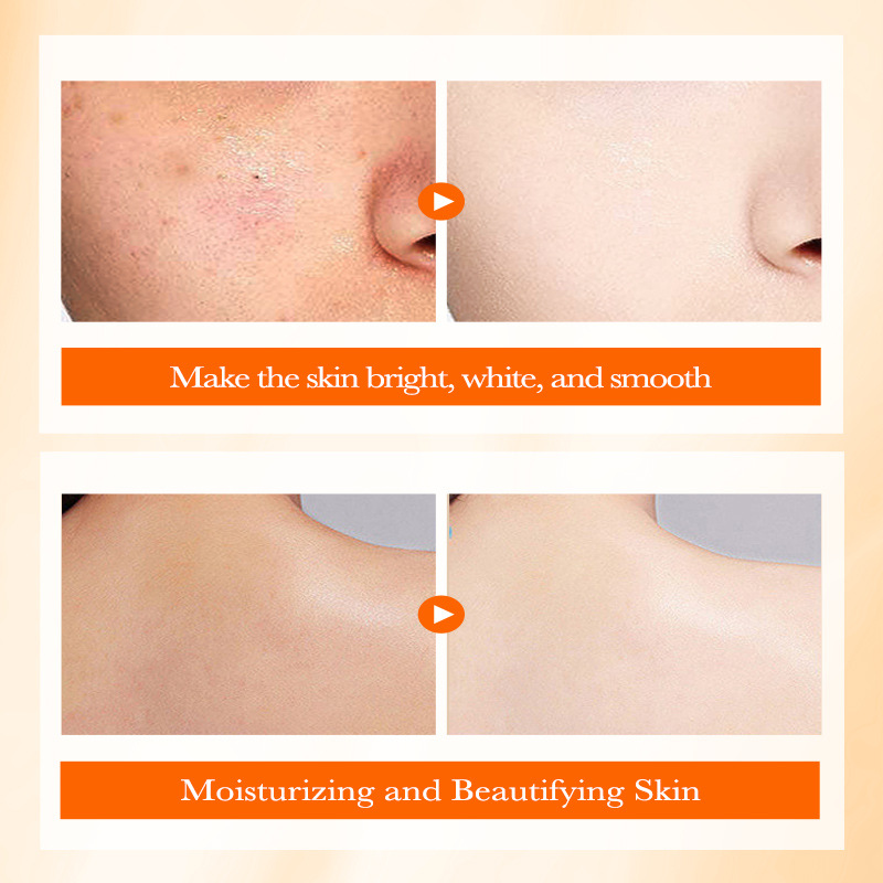 Alle Engels SADOER5 Heavy VC Nicotinamide Body Makeup Cream_voghion.com