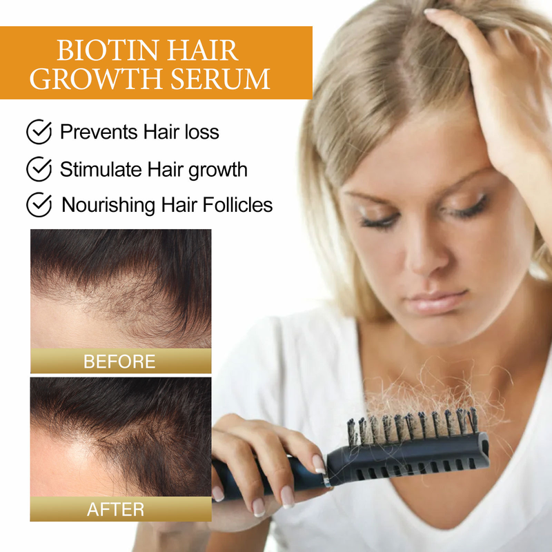 OUHOE Biotină Anti-cădere, Reparare fixă, Hidratare rădăcină, Esență de balsam de păr dens_voghion.com