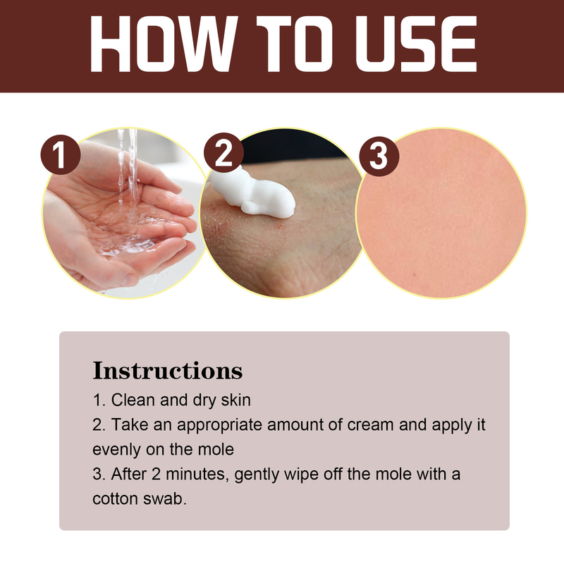 South Moon Warzencreme, Tiefenreinigung der Haut, fleischige Muttermale, schwarze Muttermale, Hühneraugen, reparierende und glättende Haut, Warzencreme_voghion.com