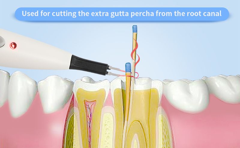 Tandvlees met 4 tips Endo Obturatie Systeem Tandheelkundige Dissoed Breaker Gutta Percha Cutter_voghion.com