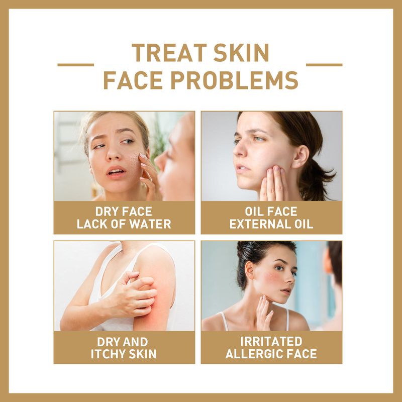 EELHOE Rice Deeply Repairs Barrier, Firms, Softens, and Moisturizes Facial Skin Toner_voghion.com