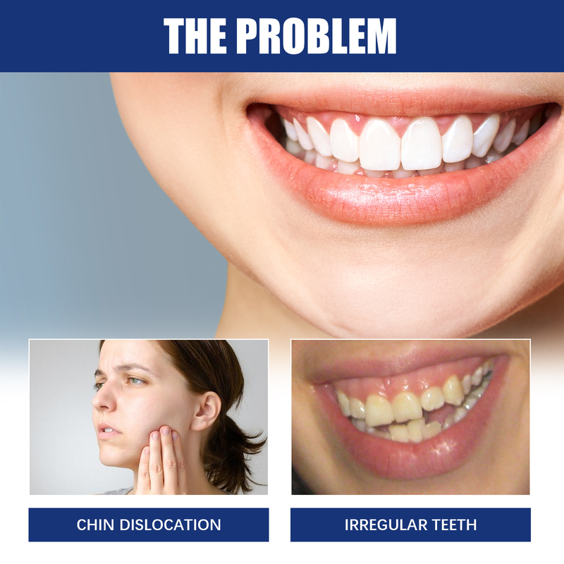 Jawbone Upassung schéine Bracket fir d'Reparatioun vu Kieferzréckzéiung an Zänn Irregularitéit, Bucktooth Oral Care Bracket_voghion.com