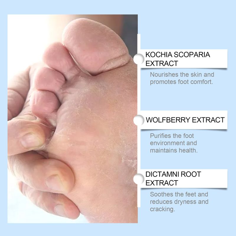 Ximonth Daily Cleaning Gentle Moisturizing Foot Care External Spray_voghion.com