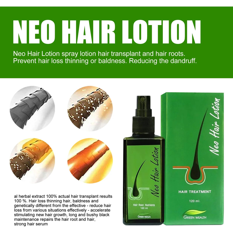 Growth Original Neo Uniex Anti Hair Lo Pilatory Natural Extract Baldne Lotion Eence Oil Repair Grow Spray tion_voghion.com