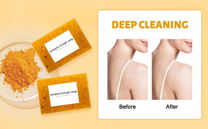COLOTTE Lemon Cookie Sapone naturale fatto a mano per viso e corpo alla curcuma per una pelle liscia, sapone detergente profondo per uomo e donna (2_voghion.com