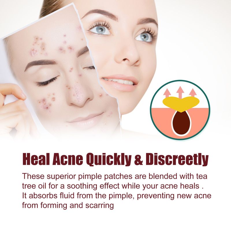 Jaysuing Love Mild Spot Acne Care Patch_voghion.com