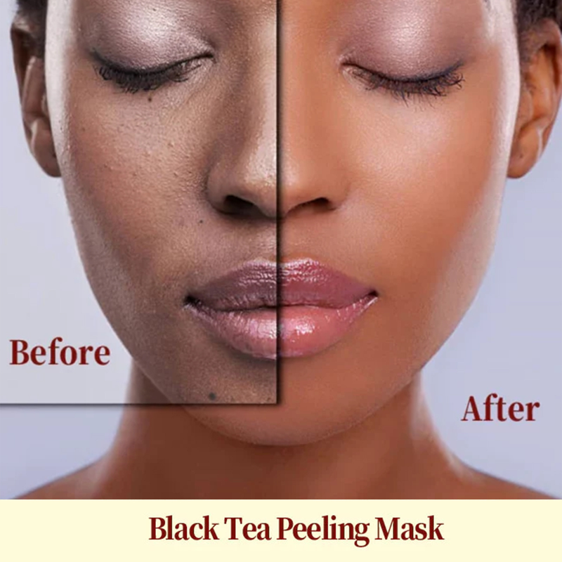 EELHOE Ginseng Ört Slitande Pormask Ta bort Keratin Reparera Mörker Avsaltningsfläck Melanin ansiktsmask_voghion.com