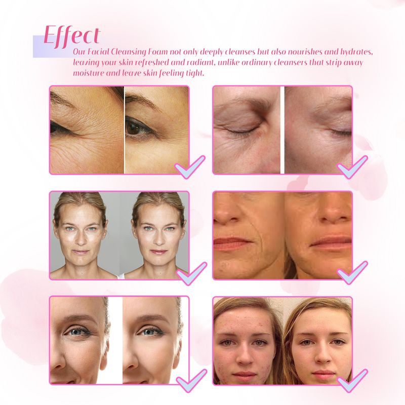 Hoygi Rose foam Oil Control Deep Cleansing Pore Delicate Brightening Firming Facial Cleanser_voghion.com