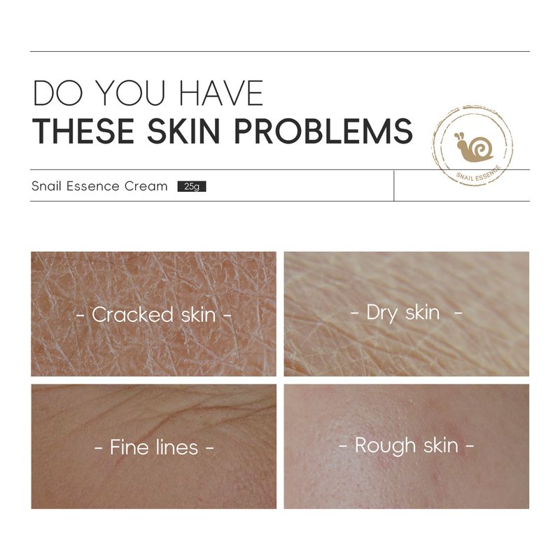 Emulsione Crema all'Essenza di Lumaca 25g Prodotti Idratanti per la Cura della Pelle_voghion.com