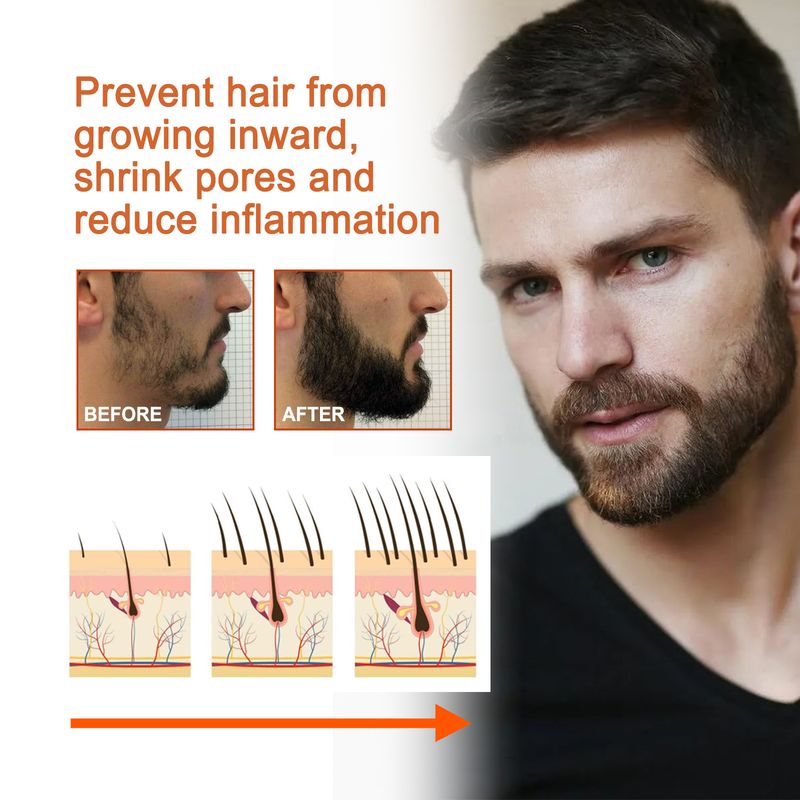 Powerful Beard Growth Oil for Faster and Thicker Hair Growth, Nourishing and Moisturizing Formula for Men_voghion.com