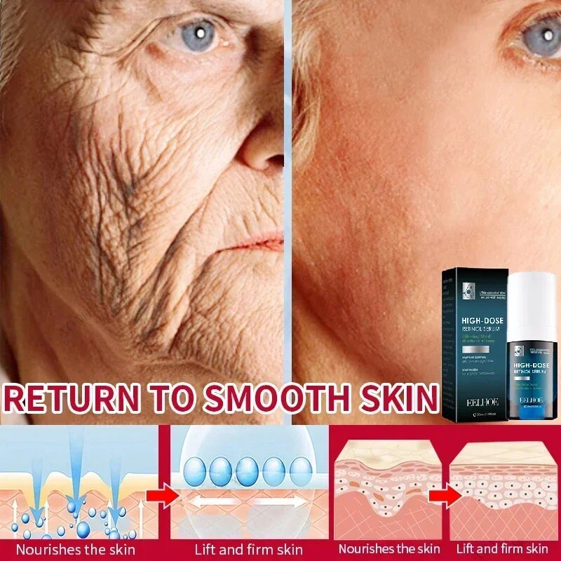cream, anti-aging Anti-wrinkle essence, facial firming and whitening, dark circle removal, fine lines reductio_voghion.com
