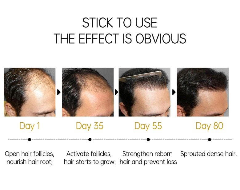 Hairinque fluffy long conserved essential oil growth hair care scalp nutrition ball essay_voghion.com