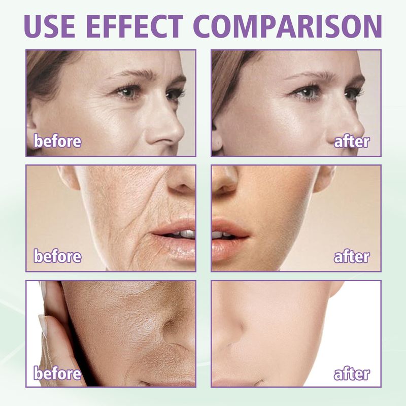 Hoygi Wrinkle Reducing Lifting Cream Reduces Eye Bags, Fine Lines, Anti-aging Skin, Smooth, Delicate, And Elastic_voghion.com