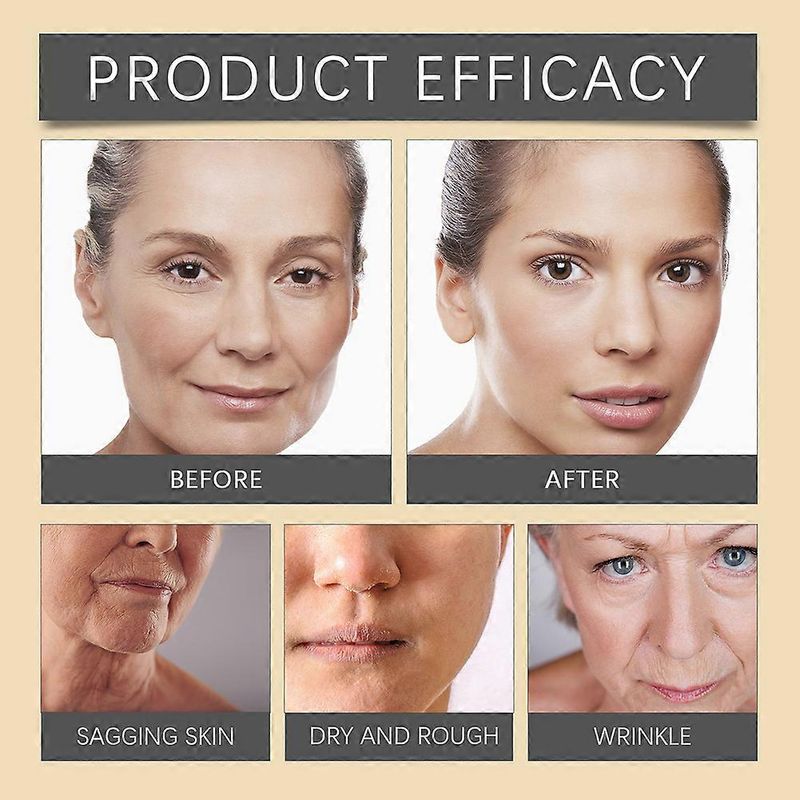 1/2/3X Bee Venom Wrinkle Removal Cream, Bee Venom Anti-Wrinkle Firming Cream, Bee Venom Cream, Moisturizing, Lifting & Recovery For All Skin Type_voghion.com