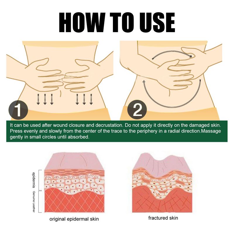 Skin Repair Cream er en daglig skånsom fuktighetskrem for kroppen, brukt til å reparere og forbedre hudkvaliteten_voghion.com