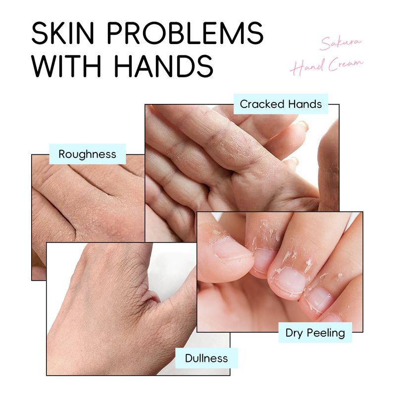 Crema mani Laco Sakura 30 g - Intensamente idratante e rinfrescante con estratto di fiori di ciliegio_voghion.com