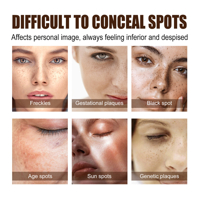 Cream Beautiful Freckle Moisturizes and Moisturizes Freckles, Blackspots, Yellowish Brown Spots, and Melanin Whitening s,_voghion.com
