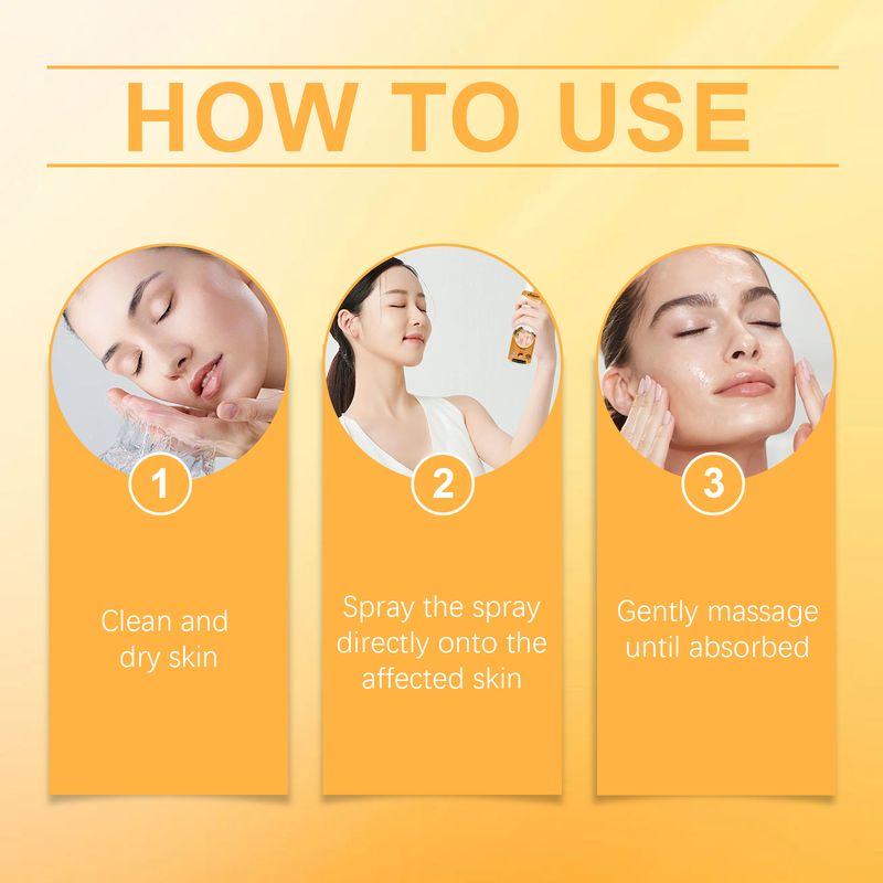 Ximonth Bienengift-Pflegespray gegen Schuppenflechte, Schuppenflechte-Spray, Kräuterkühlung, Anti-Juckreiz-Hautpflege, Anti-Schuppen, leichtes Rötungsspray_voghion.com