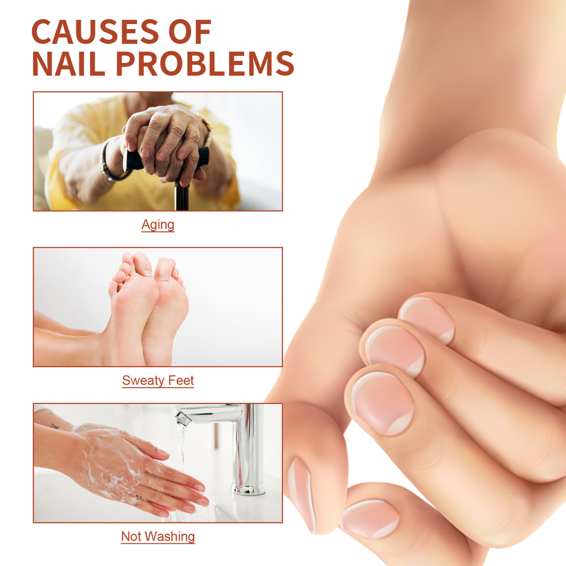 Cuidado de uñas Esencia hermosa Manos y pies Reparación de uñas grises Engrosamiento de uñas suave Hidratación Brillo Cuidado de uñas esencia_voghion.com