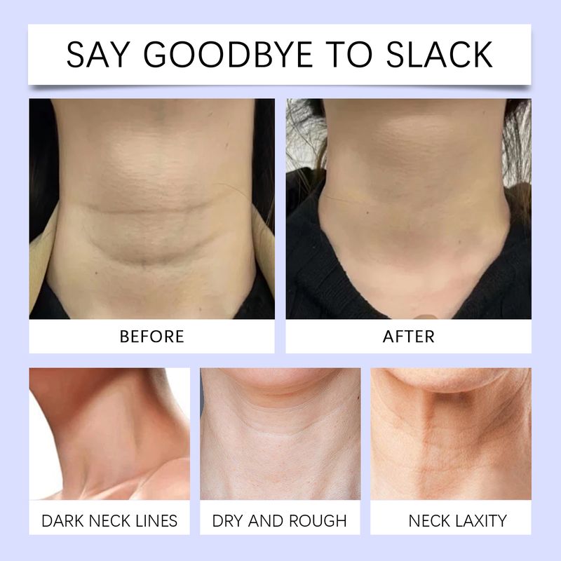 West&Month Neck Firming And Lifting Cream Refreshing, Moisturizing, Hydrating And Gently Nourishing Neck Care_voghion.com