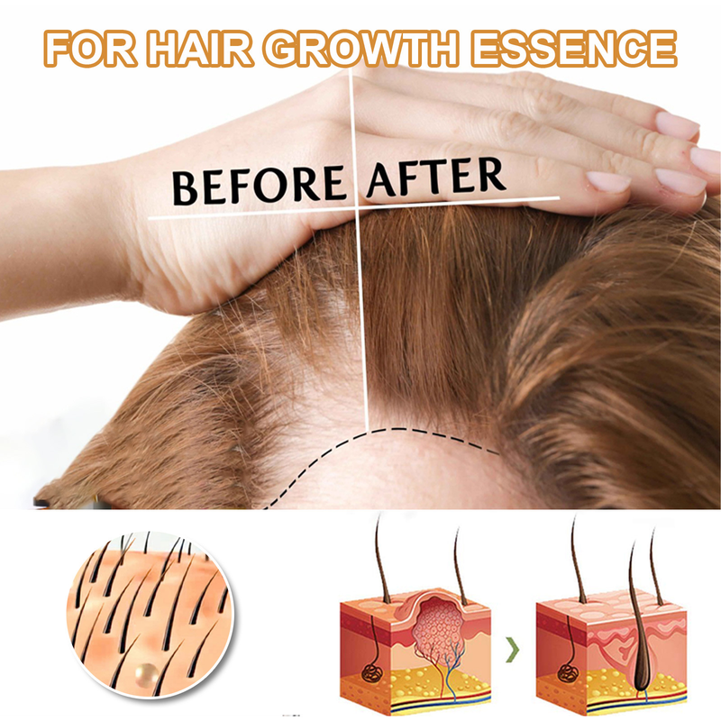 Essence EELHOE MiShui Oil migliora i danni secchi, furiosi e bruciati ai capelli, idrata e ripara i capelli_voghion.com