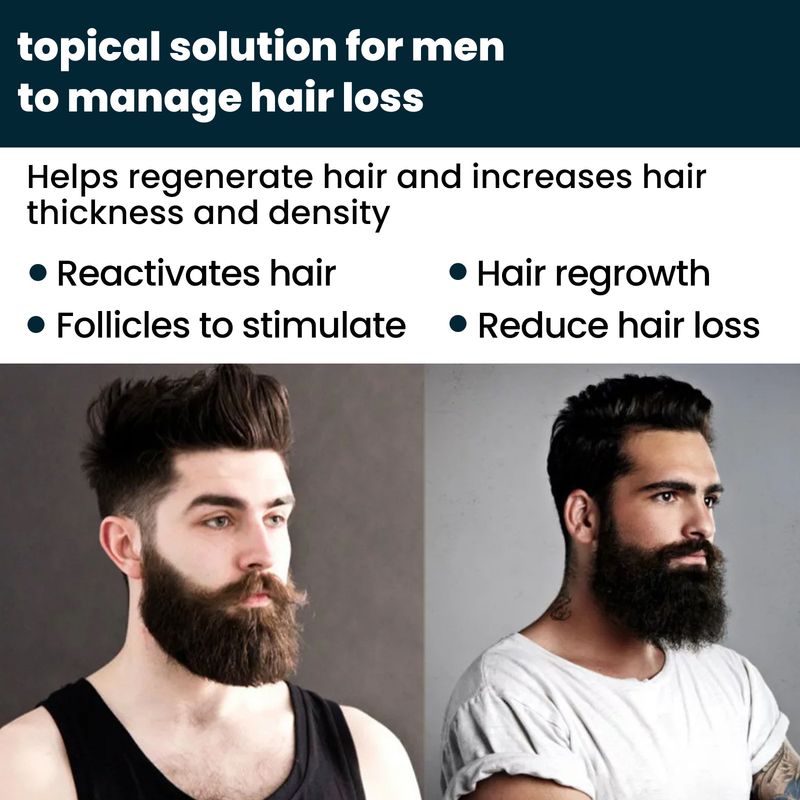 Lotion für Männer, pflegende Pflege, Anti-Fallen, festes Haar, dichte, feuchtigkeitsspendende Essenz, reaktiviert das Nachwachsen der Haare, reduziert Haarausfall_voghion.com