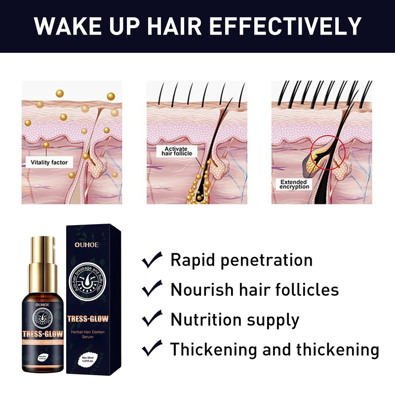 Siero per la crescita dei capelli Anti perdita di capelli Addensare Idratante Trattamento del cuoio capelluto Barba Follicoli piliferi Riparazione nutriente Radice dei capelli Cura dello zenzero_voghion.com