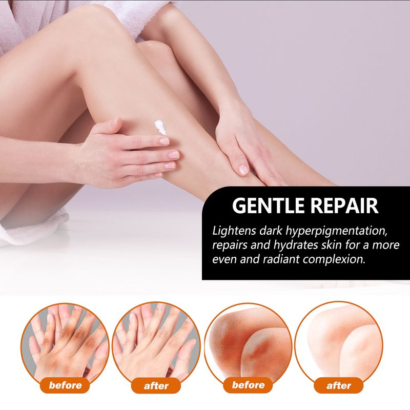 Ginocchio Gomito Ascella Corpo Clean Bar Idratare Sbiancare Acanthosis Nigricans Trattamento Carbone di Bambù Fatto a Mano_voghion.com
